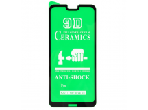 Защитное стекло-плёнка Huawei P20 LITE/NOVA 3E