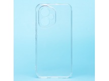 Чехол-накладка - Ultra Slim для "Honor 400 Global" (прозрачный) (240638)